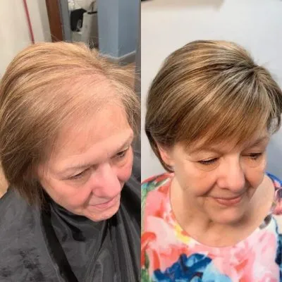 female hair loss replacement wigs toppers green bay wisconsin female hair loss replacement wigs toppers green bay wisconsin