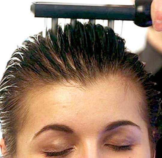 scalp-stimulation-greem-bay-appleton-wi Scalp Stimulation - Green Bay, Appleton, WI